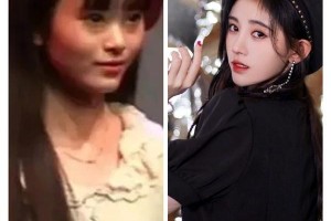 鞠婧祎陈小纭五官修整成功案例解析