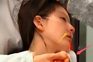 赵露思突发植物性神经综合症，病情严重暂停工作